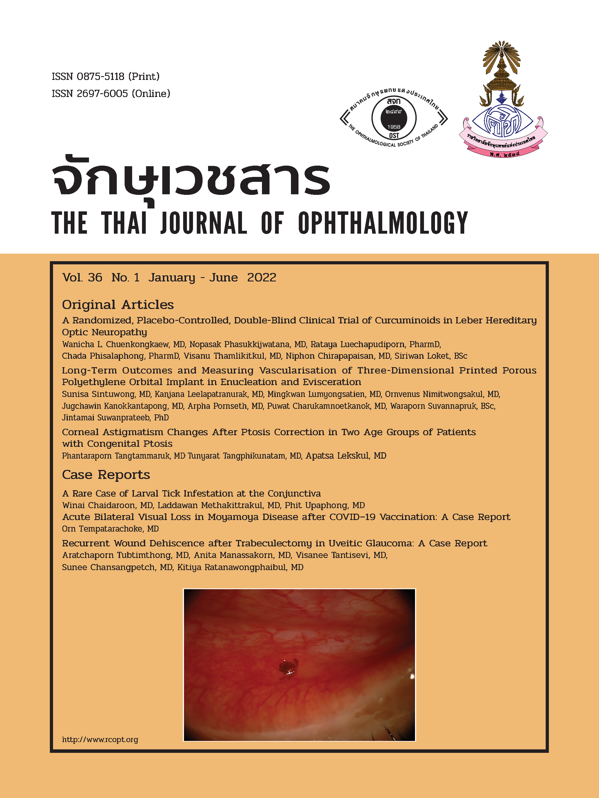 Cover J Ophthalmol-36-1-65-E5new.png